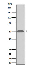 Western blot analysis of Thromboxane A2 receptor expression in human platelet cell lysate.