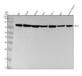 Anti-IKBKE Monoclonal Antibody