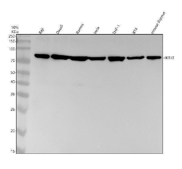 Anti-IKBKE Monoclonal Antibody
