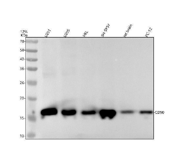 Anti-CD90 / Thy1 Rabbit Monoclonal Antibody