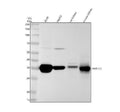 Anti-AKR1C3 Rabbit Monoclonal Antibody