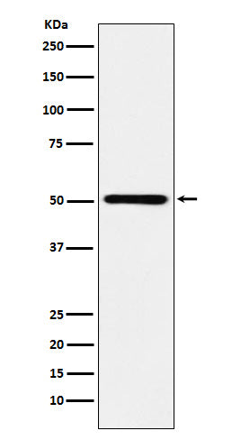 Western blot analysis of RING1 expression in Ramos cell lysate.