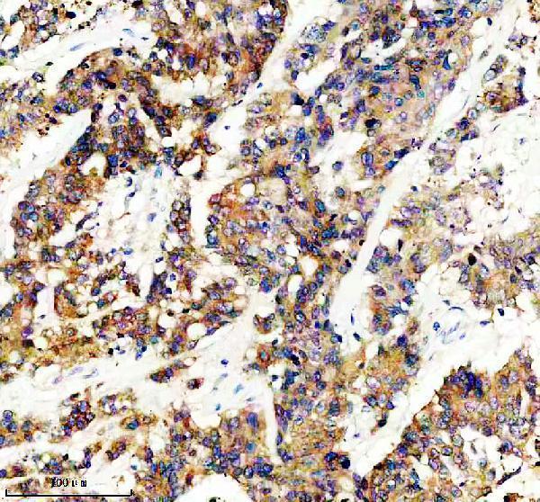 Anti-GLB1 Rabbit Monoclonal Antibody