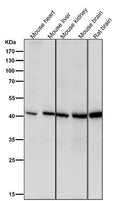 All lanes use the Antibody at 1:1K dilution for 1 hour at room temperature.