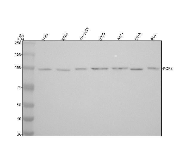 Anti-ROR2 Rabbit Monoclonal Antibody