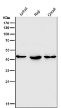 All lanes use the Antibody at 1:3K dilution for 1 hour at room temperature.