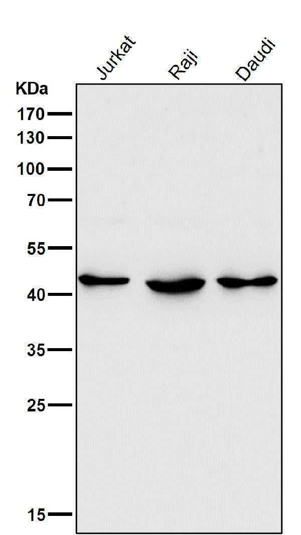 All lanes use the Antibody at 1:3K dilution for 1 hour at room temperature.