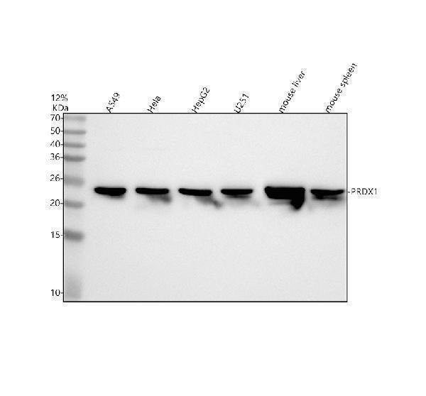 Anti-PRDX1/Peroxiredoxin 1 Rabbit Monoclonal Antibody