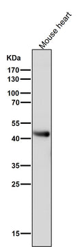 Anti-ADIPOR1 Rabbit Monoclonal Antibody