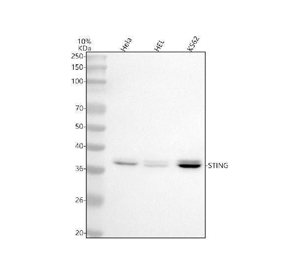 Anti-TMEM173 Monoclonal Antibody