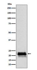 Western blot analysis of FSH beta (FSHB) expression in Human pituitary lysate.
