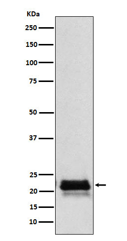 Western blot analysis of FSH beta (FSHB) expression in Human pituitary lysate.