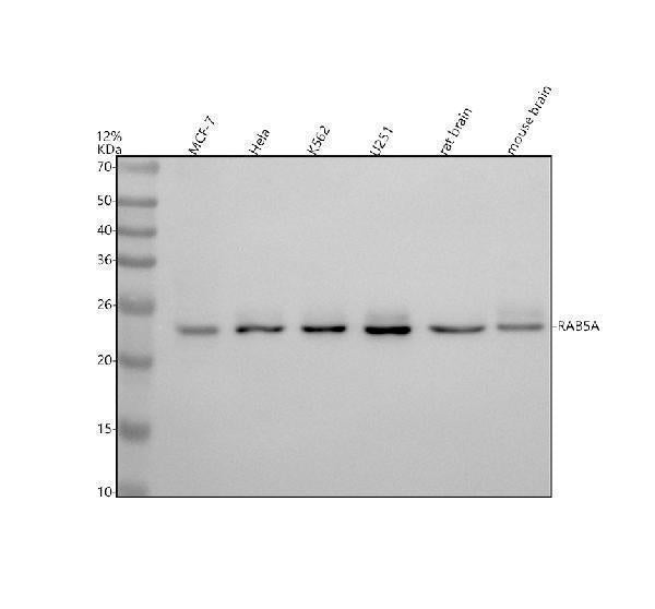 Anti-Rab5 RAB5A Rabbit Monoclonal Antibody