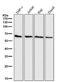 All lanes use the Antibody at 1:1K dilution for 1 hour at room temperature.