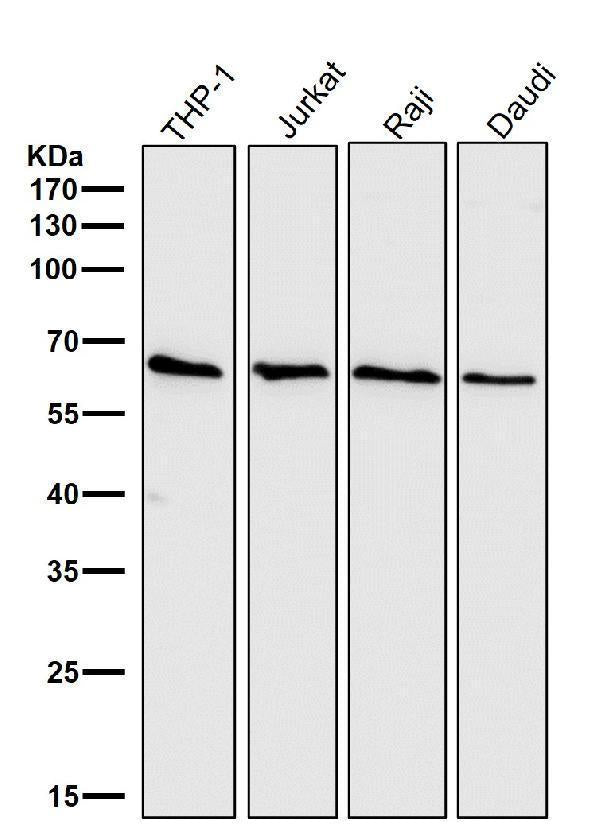 All lanes use the Antibody at 1:1K dilution for 1 hour at room temperature.