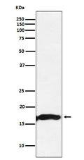 Western blot analysis of CRYAA expression in Mouse eyeball lysate.