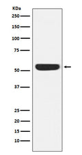 Western blot analysis of CAMKIV expression in Jurkat cell lysate.