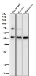 All lanes use the Antibody at 1:2K dilution for 1 hour at room temperature.