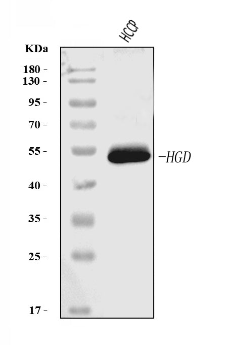 Anti-HGD Antibody Picoband® (monoclonal, 2F11E1)