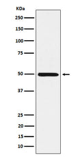 Western blot analysis of HGD expression in HepG2 cell lysate.