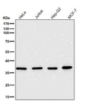 All lanes use the Antibody at 1:5K dilution for 1 hour at room temperature.