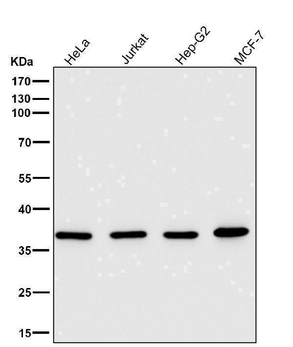 All lanes use the Antibody at 1:5K dilution for 1 hour at room temperature.