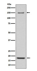 Western blot analysis of Integrin alpha 5 expression in Mouse heart lysate.