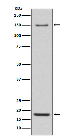 Western blot analysis of Integrin alpha 5 expression in Mouse heart lysate.