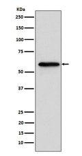 Western blot analysis of Retinoic Acid Receptor beta expression in MCF7 cell lysate.