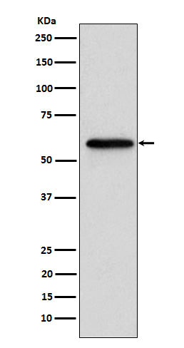 Western blot analysis of Retinoic Acid Receptor beta expression in MCF7 cell lysate.