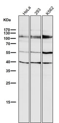 All lanes use the Antibody at 1:2K dilution for 1 hour at room temperature.