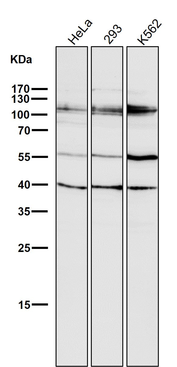 All lanes use the Antibody at 1:2K dilution for 1 hour at room temperature.