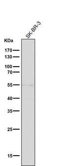 All lanes use the Antibody at 1:1K dilution for 1 hour at room temperature.
