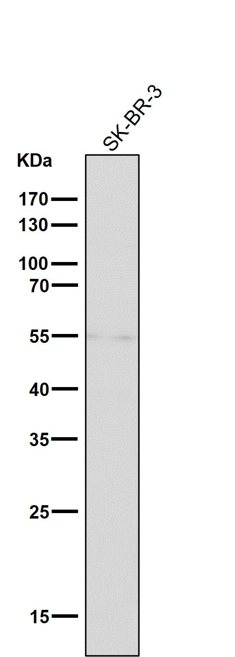 All lanes use the Antibody at 1:1K dilution for 1 hour at room temperature.