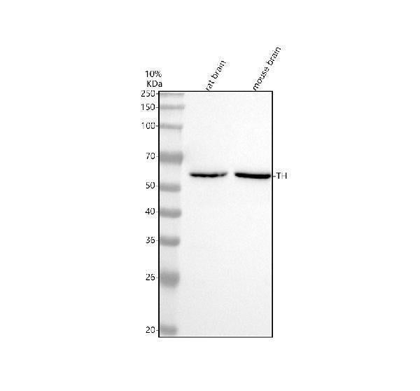 Anti-Tyrosine Hydroxylase TH Rabbit Monoclonal Antibody