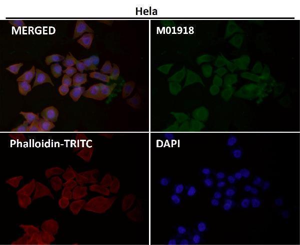 Anti-IKK alpha+beta CHUK Rabbit Monoclonal Antibody