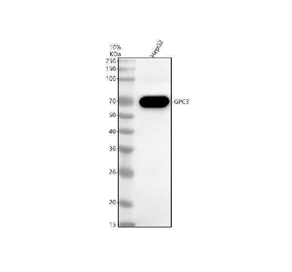 Anti-Glypican 3 Monoclonal Antibody