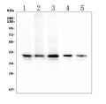 Anti-RP2 Antibody Picoband® (monoclonal, 3D7)