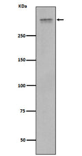 Western blot analysis of Plectin expression in Jurkat cell lysate.
