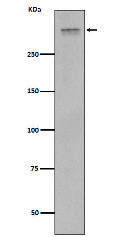 Western blot analysis of Plectin expression in Jurkat cell lysate.