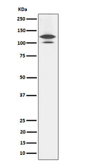 Western blot analysis of RASA1 expression in Rat brain cell lysate.