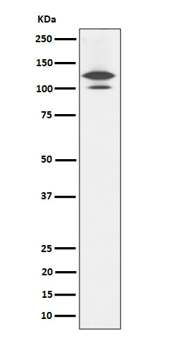 Western blot analysis of RASA1 expression in Rat brain cell lysate.