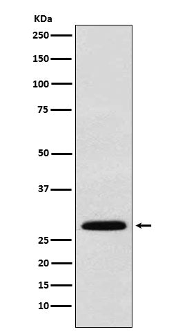Western blot analysis of KGF expression in 293T cell lysate.