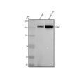 Anti-Integrin alpha 2 ITGA2 Rabbit Monoclonal Antibody