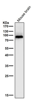 All lanes use the Antibody at 1:1W dilution for 1 hour at room temperature.
