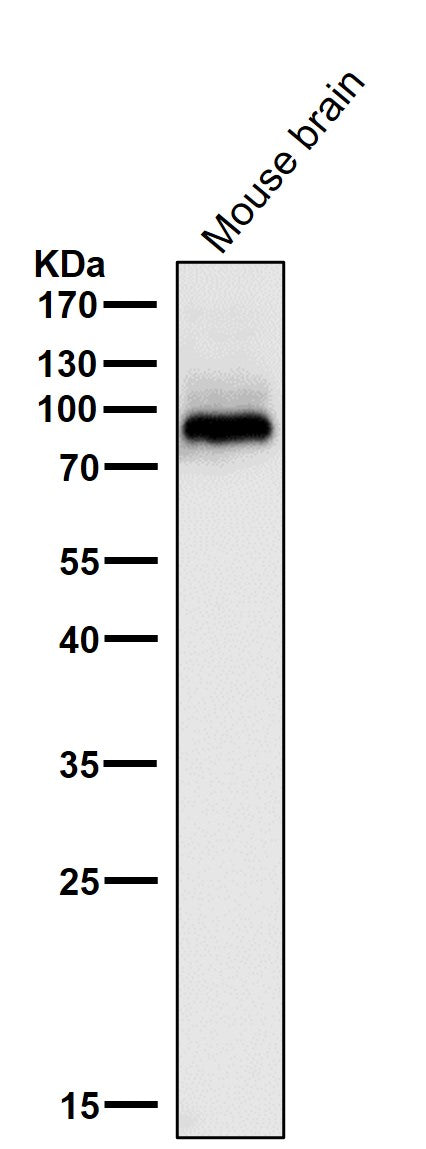 All lanes use the Antibody at 1:1W dilution for 1 hour at room temperature.