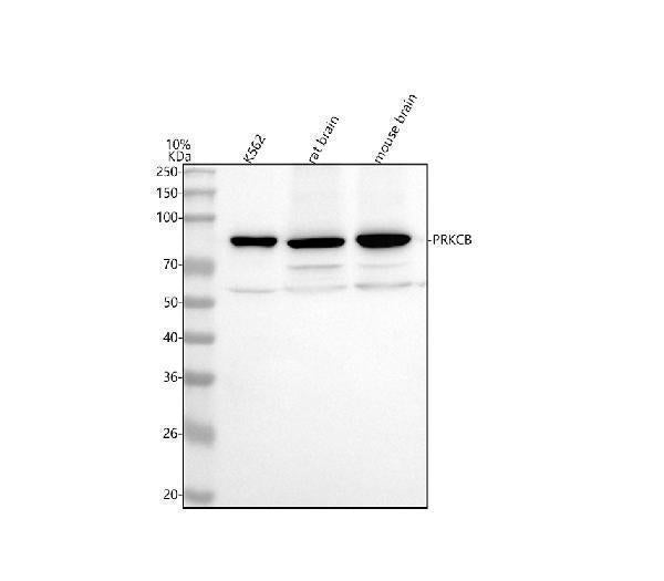 Anti-PKC beta 2 PRKCB Rabbit Monoclonal Antibody