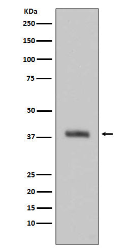 Western blot analysis of HTRA2 expression in Jurkat cell lysate.