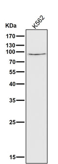 All lanes use the Antibody at 1:1K dilution for 1 hour at room temperature.