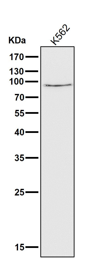 All lanes use the Antibody at 1:1K dilution for 1 hour at room temperature.